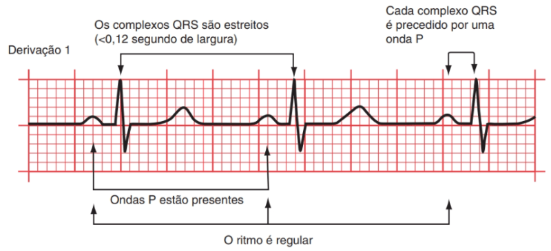 Eletrocardiograma: Como Funciona e Interpretação – Biomedicina Online
